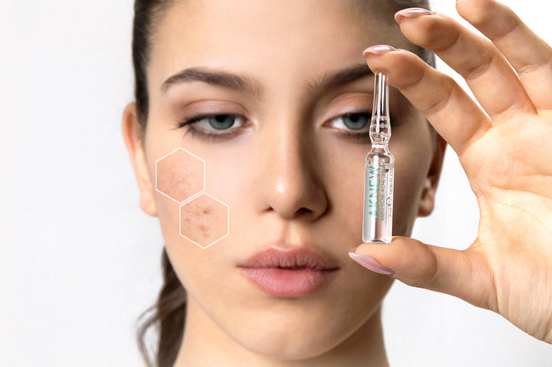 Pelle impura, mista, con presenza di imperfezioni o con acne? Ecco come trattarla